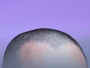 聪明绝顶