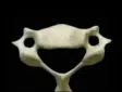 Vertebra C6-Wallet