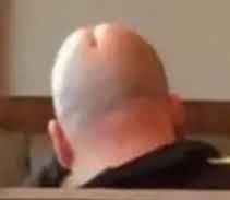 DICKHEAD